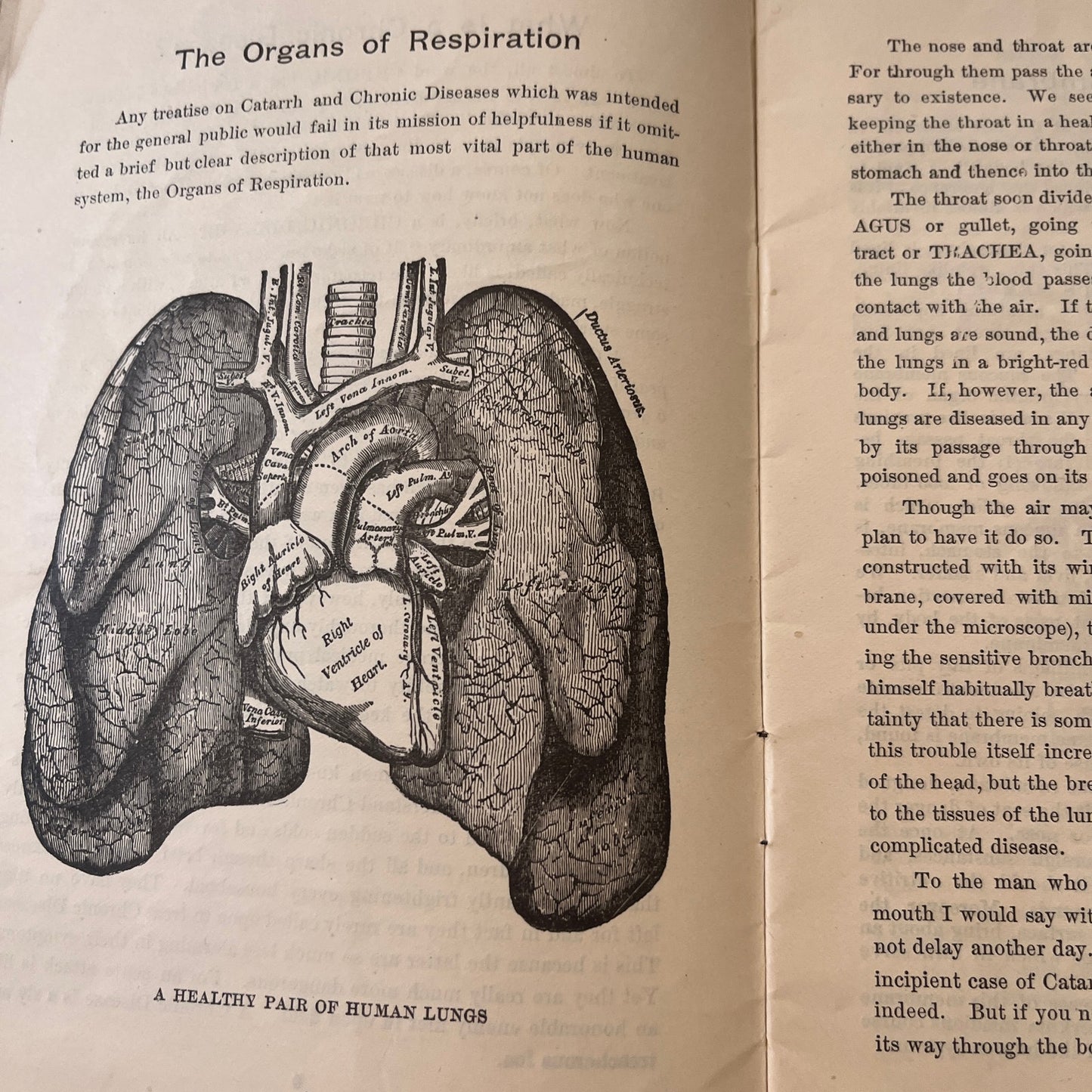 Catarrh Treatment Health Specialist Sproule Promo Booklet c1900 Original TK3-G