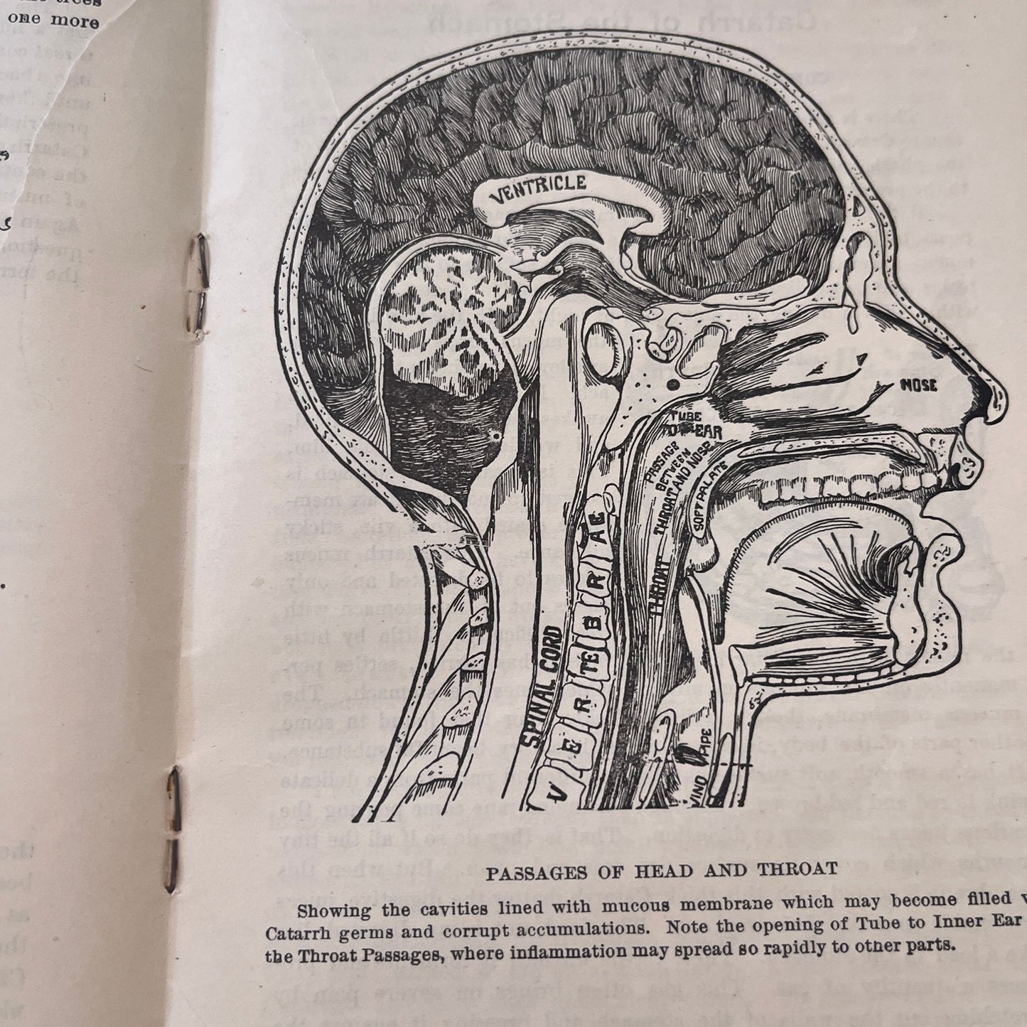 Catarrh Treatment Health Specialist Sproule Promo Booklet c1900 Original TK3-G