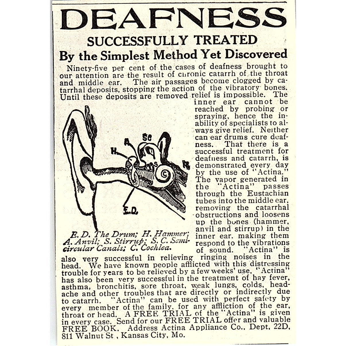 Deafness Treatment Actina Appliance Co Kansas City MO 1914 Original Ad AF3-Q4