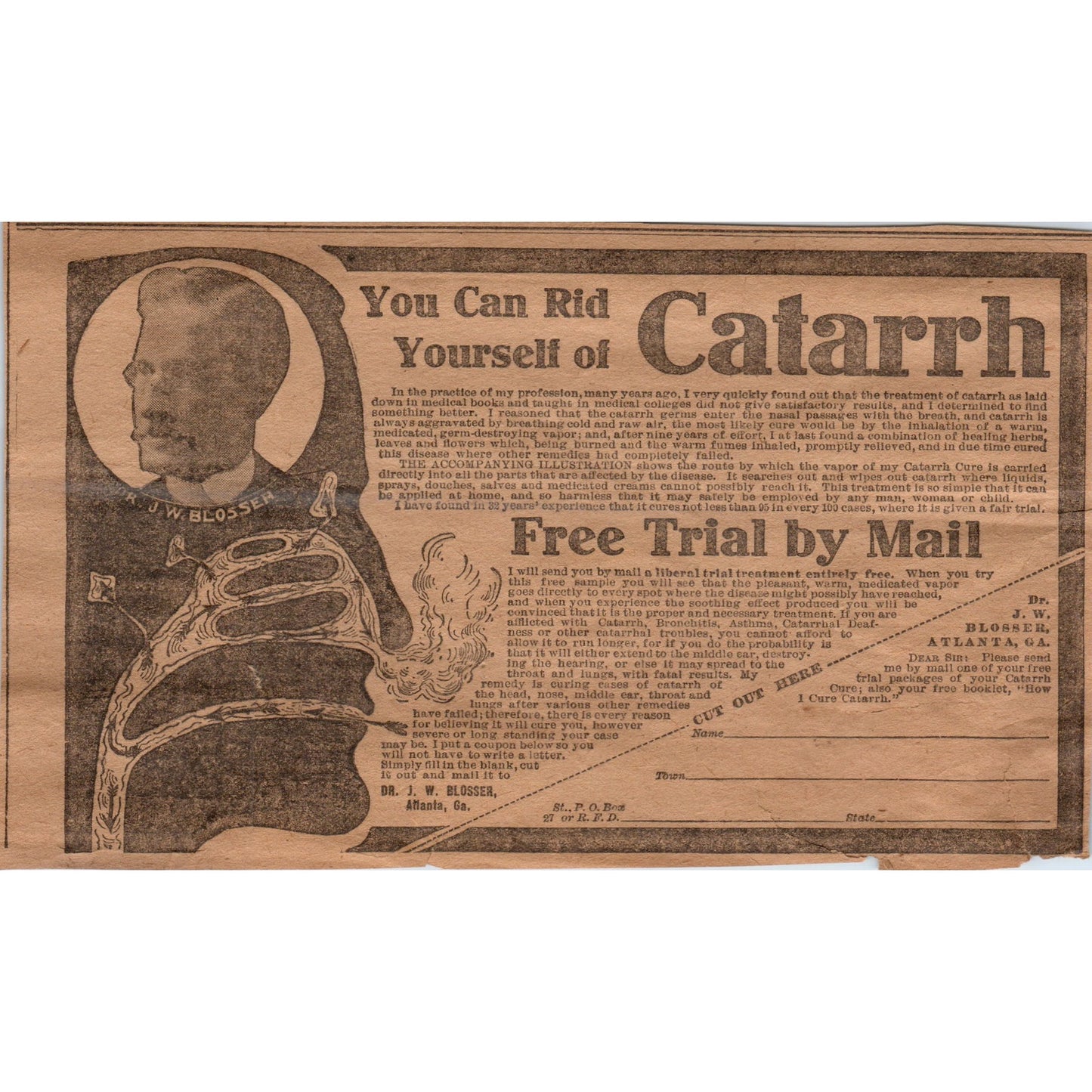 Catarrh Cure J.W. Blosser Atlanta Georgia 1906 Original Ad AB6-CL1