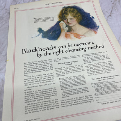 Blackheads Woodbury Skin Preparation Andrew Jergens Co Cincinnati 1924 Ad FL6-11