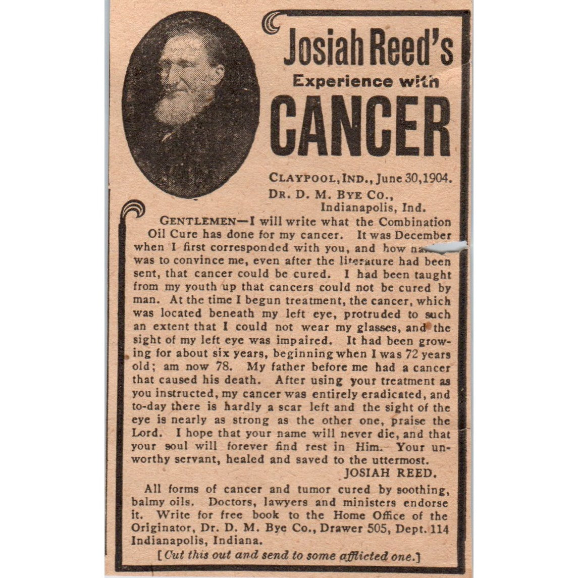 Josiah Reed's Experience with Cancer D.M. Bye Co Indianapolis 1905 Ad AF1-NH4