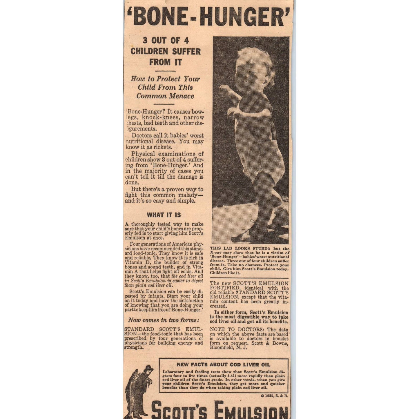 1935 Minneapolis Newspaper Ad Quackery Scott's Emulsion Bone Hunger FL5-3-1