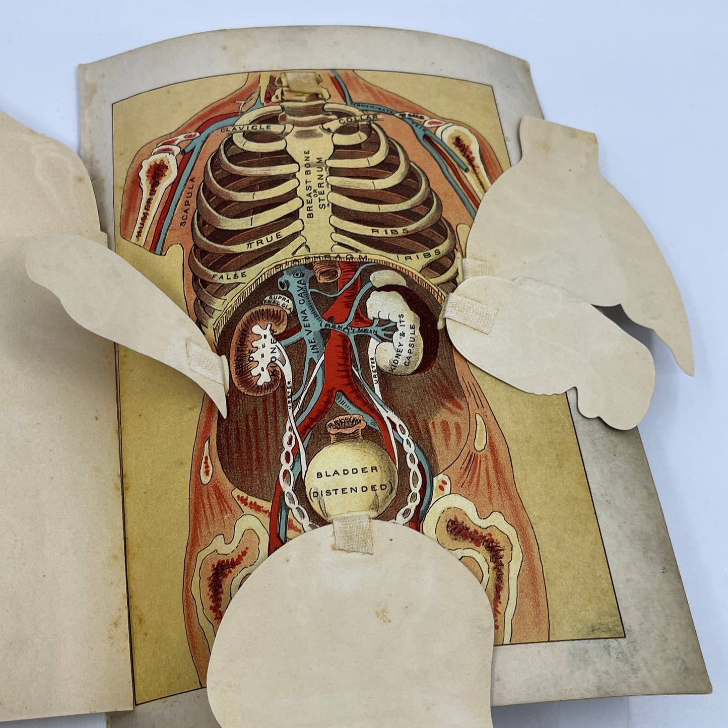 1892 Lithograph Anatomical Fold-Out Torso In 6 Sections. Bradley & Woodruff AC8