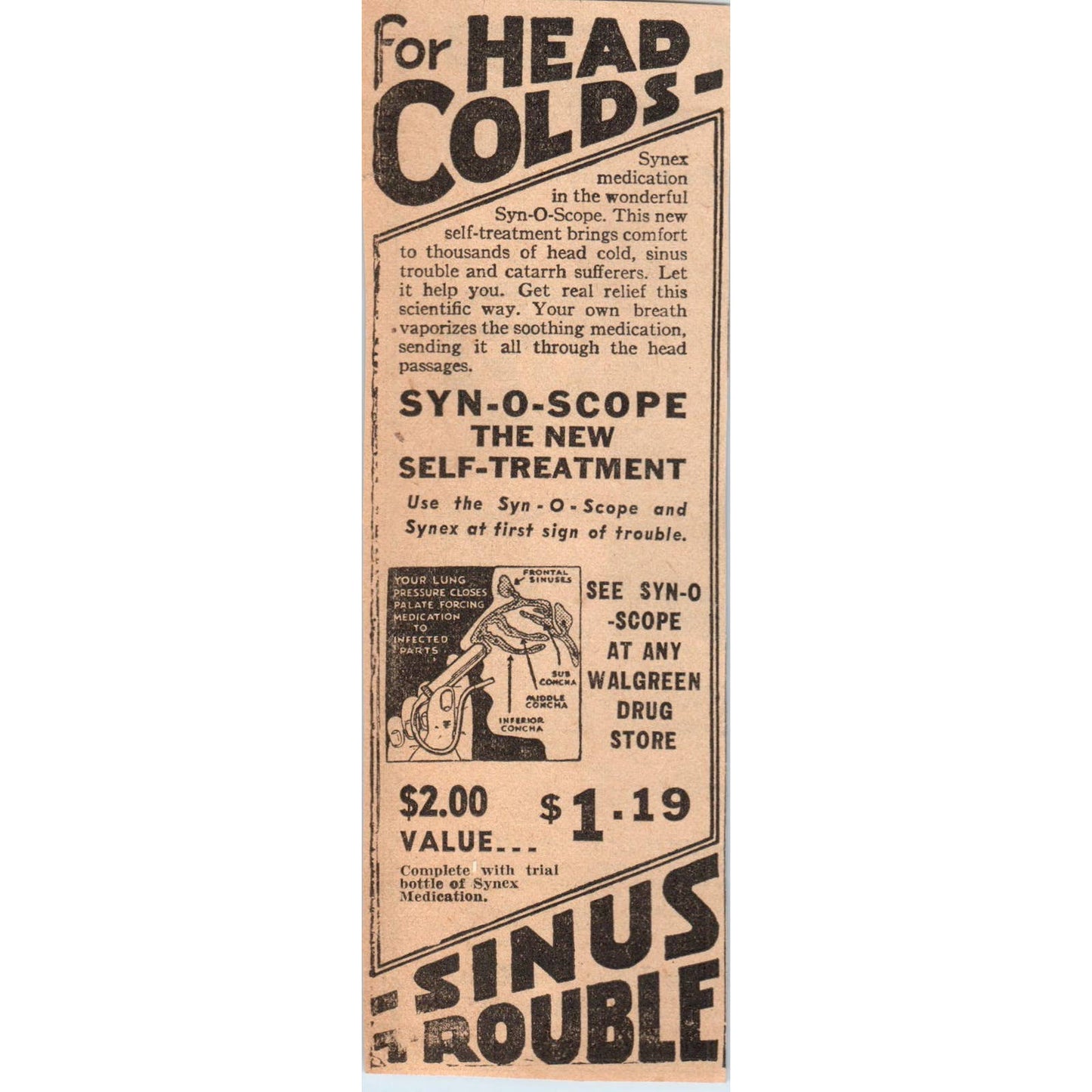 1935 Minneapolis Journal Newspaper Ad Quackery Syn-o-Scope for Head Colds FL5-4