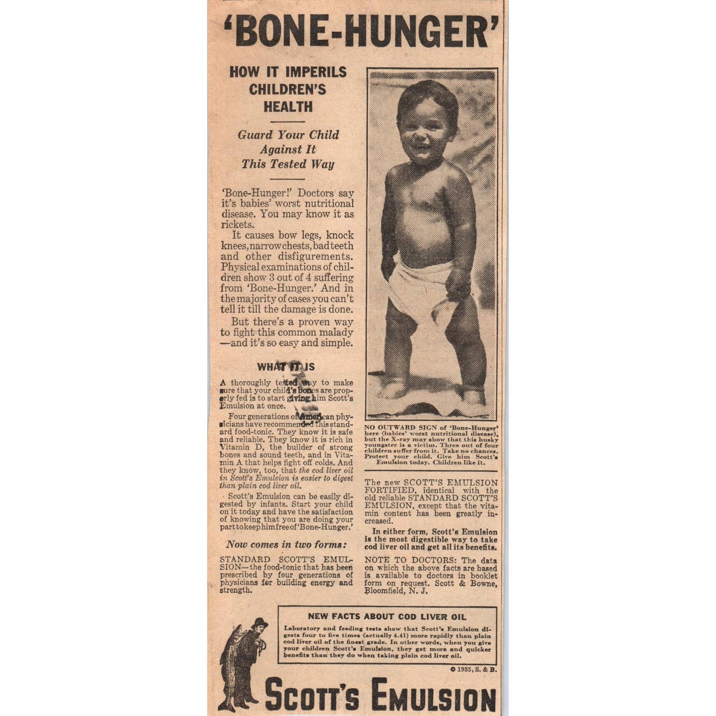 1935 Minneapolis Newspaper Ad Quackery Scott's Emulsion Bone Hunger FL5-3-2