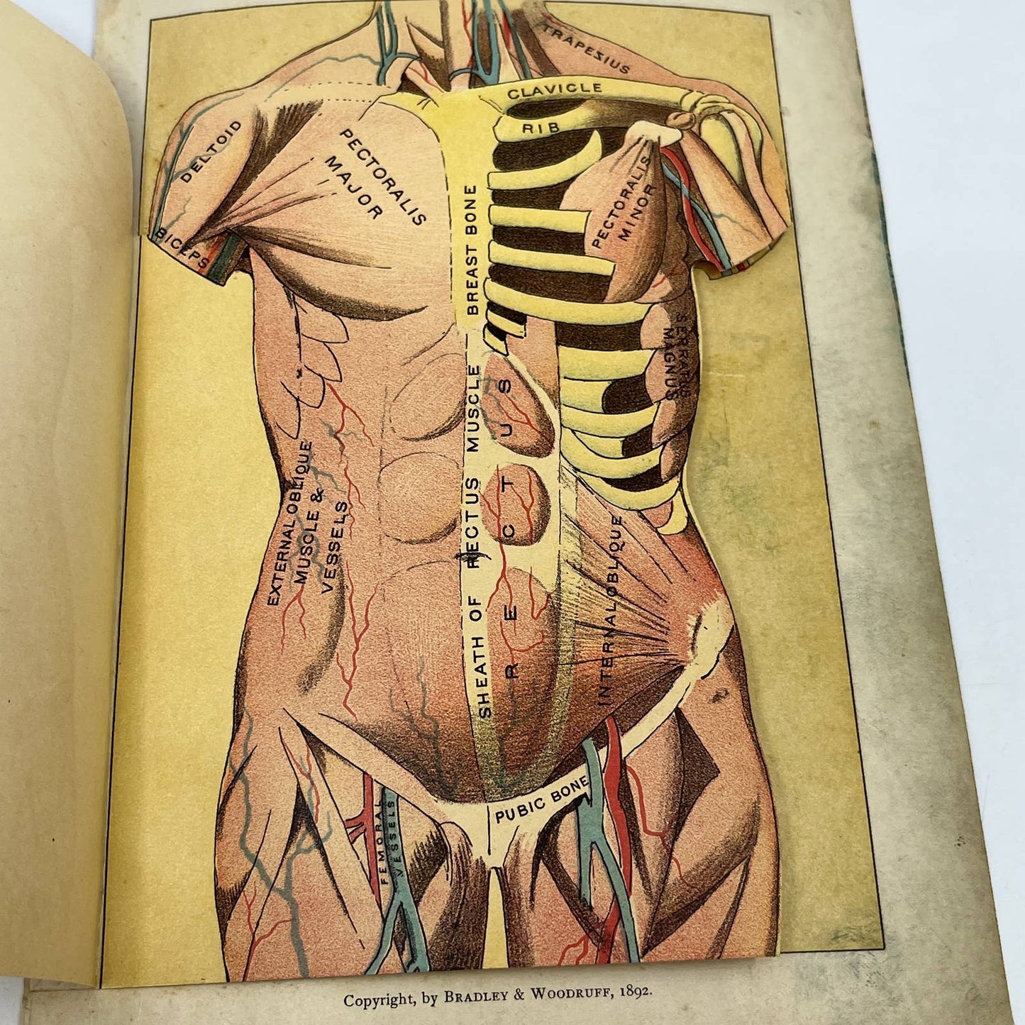 1892 Lithograph Anatomical Fold-Out Torso In 6 Sections. Bradley & Woodruff AC8